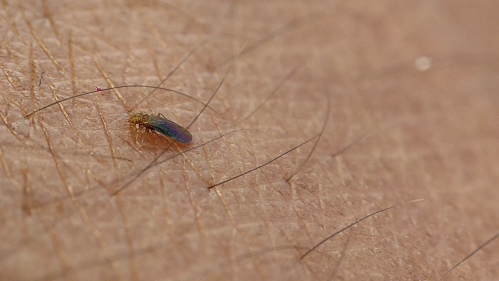 Do Ticks Live in Pine Trees UpGardening